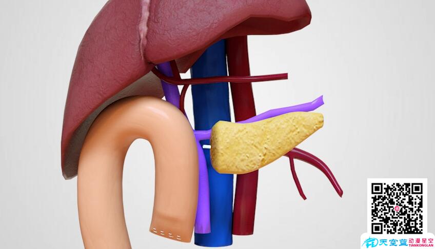三維3d動(dòng)畫演示胰十二指腸切除術(shù).jpg