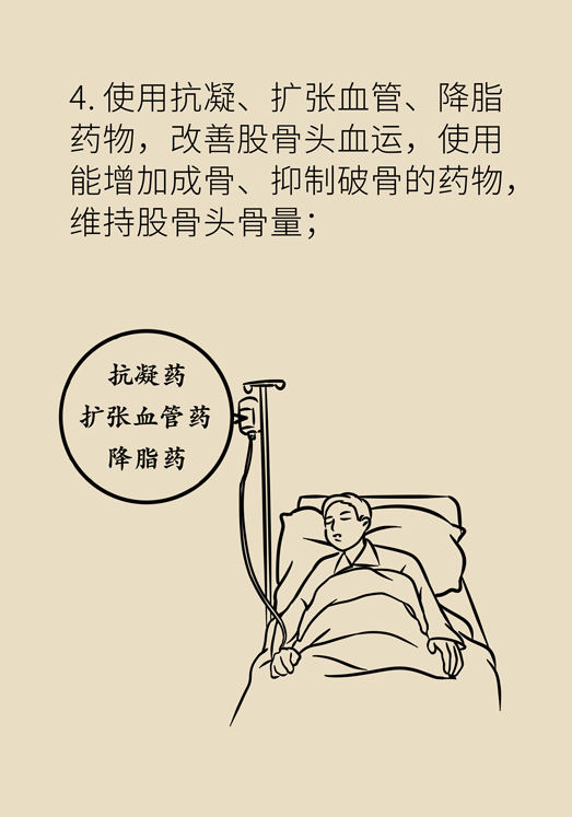 激素會帶來股骨頭壞死的后遺癥嗎？