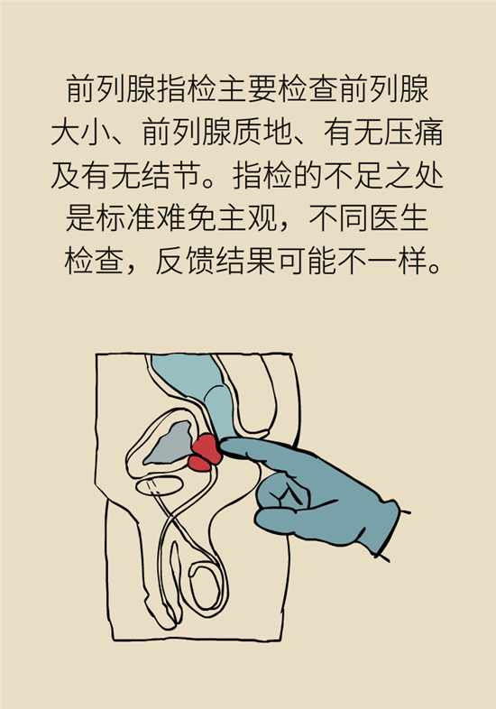 前列腺肥大了還能縮小嗎？