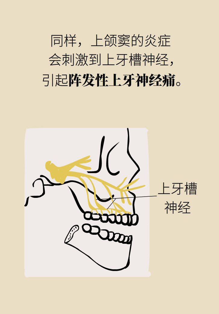 為什么鼻竇發(fā)炎，疼的卻是頭、眼和牙？