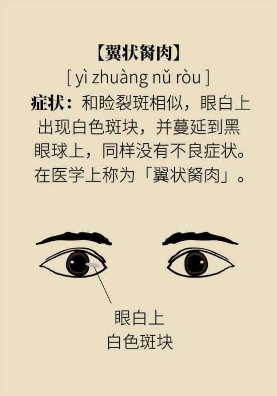 眼白有斑塊、出血要緊嗎？專家：名字唬人但問(wèn)題不大