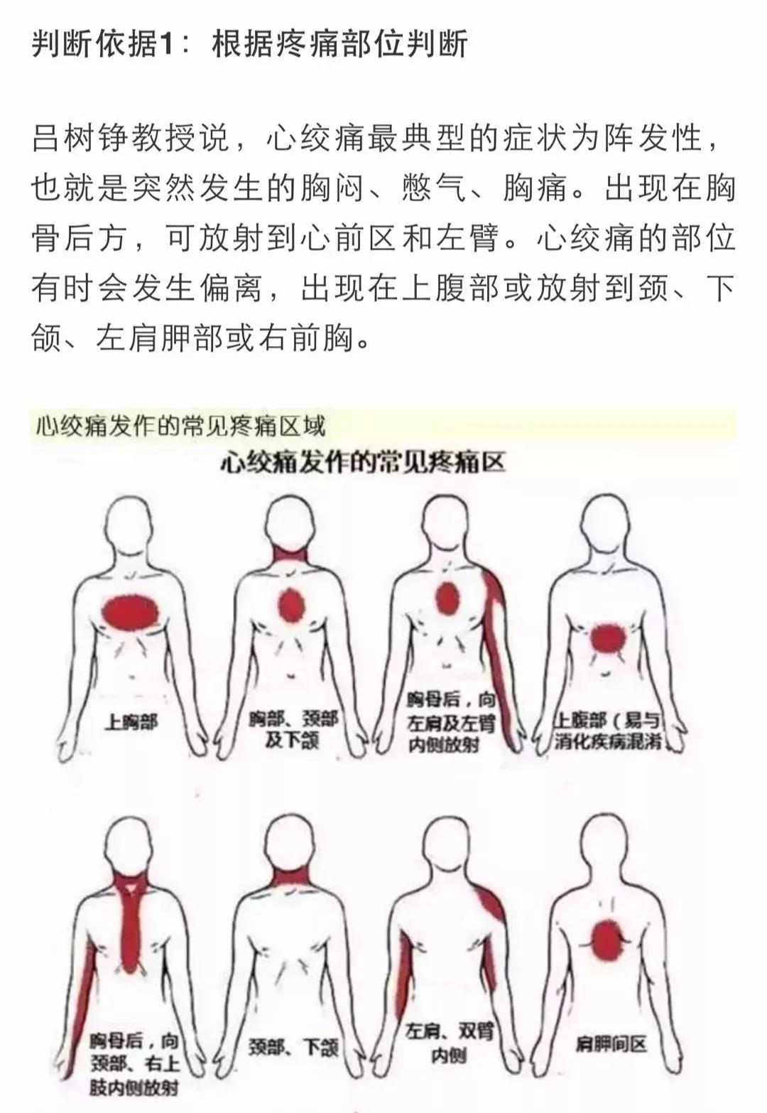 心梗有前兆！心臟發(fā)出的警報(bào)你在意了嗎？