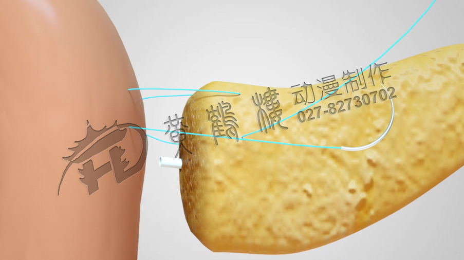 武漢醫(yī)學制作動畫公司.jpg