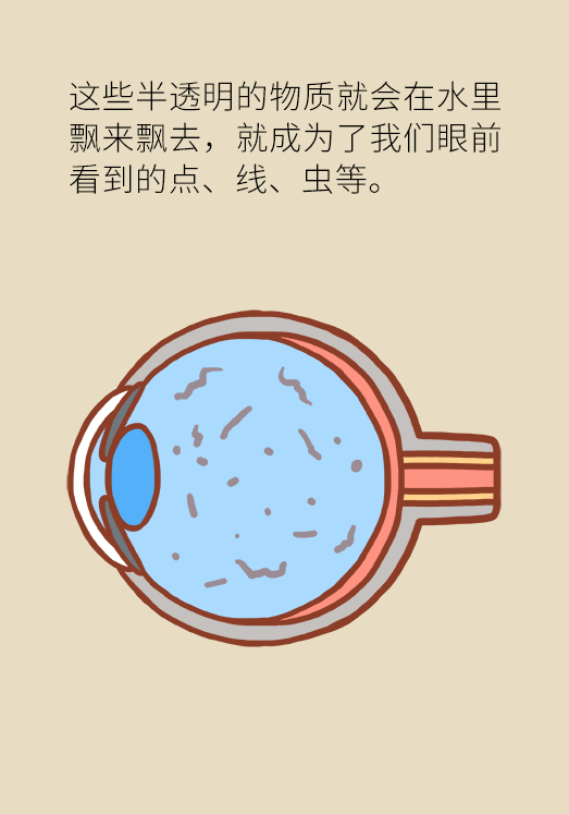 眼科醫(yī)學(xué)科普動(dòng)漫