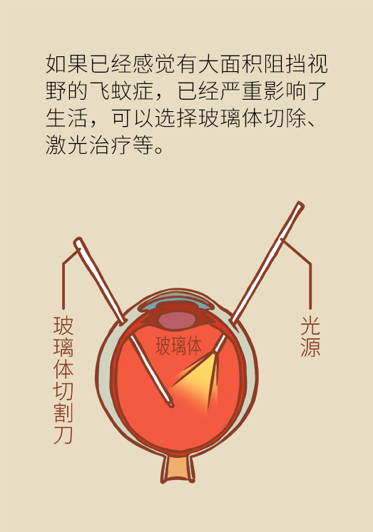 眼科醫(yī)學(xué)科普動(dòng)漫