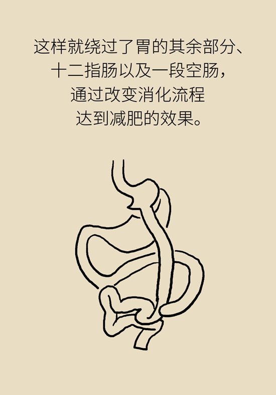 減肥醫(yī)學(xué)知識科普