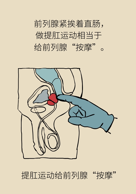 怎么做可以預(yù)防痔瘡呢？按摩前列腺、鍛煉盆底肌